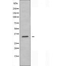 AF5251 staining A375? cells by IF/ICC. The sample were fixed with PFA and permeabilized in 0.1% Triton X-100,then blocked in 10% serum for 45 minutes at 25¡ãC. The primary antibody was diluted at 1/200 and incubated with the sample for 1 hour at 37¡ãC. An Alexa Fluor 594 conjugated goat anti-rabbit IgG (H+L) antibody(Cat.
