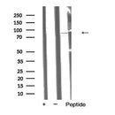 AF5417 at 1/100 staining Mouse lung tissue by IHC-P. The sample was formaldehyde fixed and a heat mediated antigen retrieval step in citrate buffer was performed. The sample was then blocked and incubated with the antibody for 1.5 hours at 22¡ãC. An HRP conjugated goat anti-rabbit antibody was used as the secondary