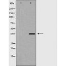 AF5419 at 1/100 staining Mouse brain tissue by IHC-P. The sample was formaldehyde fixed and a heat mediated antigen retrieval step in citrate buffer was performed. The sample was then blocked and incubated with the antibody for 1.5 hours at 22¡ãC. An HRP conjugated goat anti-rabbit antibody was used as the secondary