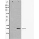 Western blot analysis of MRLC1 expression in K562 cell extract.The lane on the left is treated with the antigen-specific peptide.