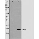 AF5425 staining Hela by IF/ICC. The sample were fixed with PFA and permeabilized in 0.1% Triton X-100,then blocked in 10% serum for 45 minutes at 25¡ãC. The primary antibody was diluted at 1/200 and incubated with the sample for 1 hour at 37¡ãC. An Alexa Fluor 594 conjugated goat anti-rabbit IgG (H+L) Ab, diluted at 1/600, was used as the secondary antibod