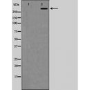 AF5487 at 1/100 staining Mouse brain tissue by IHC-P. The sample was formaldehyde fixed and a heat mediated antigen retrieval step in citrate buffer was performed. The sample was then blocked and incubated with the antibody for 1.5 hours at 22¡ãC. An HRP conjugated goat anti-rabbit antibody was used as the secondary