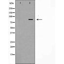 DF6001 at 1/100 staining Mouse brain tissue by IHC-P. The sample was formaldehyde fixed and a heat mediated antigen retrieval step in citrate buffer was performed. The sample was then blocked and incubated with the antibody for 1.5 hours at 22¡ãC. An HRP conjugated goat anti-rabbit antibody was used as the secondary