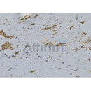Western blot analysis of extracts from PC12, using BID Antibody. The lane on the left was treated with blocking peptide.