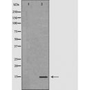 DF6035 at 1/100 staining Mouse brain tissue by IHC-P. The sample was formaldehyde fixed and a heat mediated antigen retrieval step in citrate buffer was performed. The sample was then blocked and incubated with the antibody for 1.5 hours at 22¡ãC. An HRP conjugated goat anti-rabbit antibody was used as the secondary