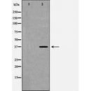 Western blot analysis of extracts of SW480, using FAS antibody. The lane on the left is treated with the antigen-specific peptide.