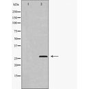 DF6043 staining HeLa cells by IF/ICC. The sample were fixed with PFA and permeabilized in 0.1% Triton X-100,then blocked in 10% serum for 45 minutes at 25¡ãC. The primary antibody was diluted at 1/200 and incubated with the sample for 1 hour at 37¡ãC. An Alexa Fluor 594 conjugated goat anti-rabbit IgG (H+L) antibody(Cat.