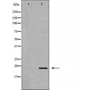 DF6045 at 1/100 staining Human lymph node tissue by IHC-P. The sample was formaldehyde fixed and a heat mediated antigen retrieval step in citrate buffer was performed. The sample was then blocked and incubated with the antibody for 1.5 hours at 22¡ãC. An HRP conjugated goat anti-rabbit antibody was used as the secondary