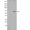 DF6052 at 1/100 staining Human spleen tissue by IHC-P. The sample was formaldehyde fixed and a heat mediated antigen retrieval step in citrate buffer was performed. The sample was then blocked and incubated with the antibody for 1.5 hours at 22¡ãC. An HRP conjugated goat anti-rabbit antibody was used as the secondary