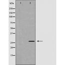 DF6061 at 1/100 staining Human uterus tissue by IHC-P. The sample was formaldehyde fixed and a heat mediated antigen retrieval step in citrate buffer was performed. The sample was then blocked and incubated with the antibody for 1.5 hours at 22¡ãC. An HRP conjugated goat anti-rabbit antibody was used as the secondary