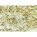 Western blot analysis of extracts from Hela, using NME1 Antibody. Lane 1 was treated with the blocking peptide.