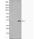 DF6063 at 1/100 staining Mouse liver tissue by IHC-P. The sample was formaldehyde fixed and a heat mediated antigen retrieval step in citrate buffer was performed. The sample was then blocked and incubated with the antibody for 1.5 hours at 22¡ãC. An HRP conjugated goat anti-rabbit antibody was used as the secondary