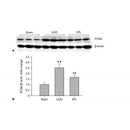 DF6067 staining Hela by IF/ICC. The sample were fixed with PFA and permeabilized in 0.1% Triton X-100,then blocked in 10% serum for 45 minutes at 25¡ãC. The primary antibody was diluted at 1/200 and incubated with the sample for 1 hour at 37¡ãC. An Alexa Fluor 594 conjugated goat anti-rabbit IgG (H+L) Ab, diluted at 1/600, was used as the secondary antibod