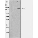 Western blot analysis of Jurkat , using PIK3CA antibody. The lane on the left is treated with the antigen-specific peptide.