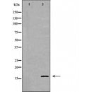 DF6077 at 1/100 staining Mouse kidney tissue by IHC-P. The sample was formaldehyde fixed and a heat mediated antigen retrieval step in citrate buffer was performed. The sample was then blocked and incubated with the antibody for 1.5 hours at 22¡ãC. An HRP conjugated goat anti-rabbit antibody was used as the secondary