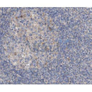 Western blot analysis of extracts from rat muscle, using VCAM1 Antibody.