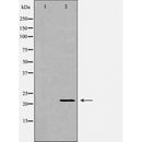 Western blot analysis of extracts of mouse livertissue, using IFNA1 antibody. The lane on the left is treated with the antigen-specific peptide.