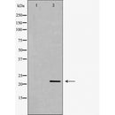 Western blot analysis of extracts of mouse eye tissue, using BIM antibody. The lane on the left is treated with the antigen-specific peptide.