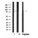 DF6100 staining COS7 by IF/ICC. The sample were fixed with PFA and permeabilized in 0.1% Triton X-100,then blocked in 10% serum for 45 minutes at 25¡ãC. The primary antibody was diluted at 1/200 and incubated with the sample for 1 hour at 37¡ãC. An Alexa Fluor 594 conjugated goat anti-rabbit IgG (H+L) Ab, diluted at 1/600, was used as the secondary antibod