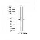 DF6103 at 1/100 staining Mouse brain tissue by IHC-P. The sample was formaldehyde fixed and a heat mediated antigen retrieval step in citrate buffer was performed. The sample was then blocked and incubated with the antibody for 1.5 hours at 22¡ãC. An HRP conjugated goat anti-rabbit antibody was used as the secondary