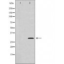 DF6105 at 1/100 staining Mouse brain tissue by IHC-P. The sample was formaldehyde fixed and a heat mediated antigen retrieval step in citrate buffer was performed. The sample was then blocked and incubated with the antibody for 1.5 hours at 22¡ãC. An HRP conjugated goat anti-rabbit antibody was used as the secondary
