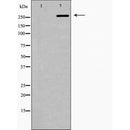 DF6106 at 1/100 staining Human urothelial cancer tissue by IHC-P. The sample was formaldehyde fixed and a heat mediated antigen retrieval step in citrate buffer was performed. The sample was then blocked and incubated with the antibody for 1.5 hours at 22¡ãC. An HRP conjugated goat anti-rabbit antibody was used as the secondary