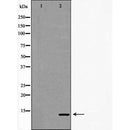 DF6112 at 1/100 staining Rat brain tissue by IHC-P. The sample was formaldehyde fixed and a heat mediated antigen retrieval step in citrate buffer was performed. The sample was then blocked and incubated with the antibody for 1.5 hours at 22¡ãC. An HRP conjugated goat anti-rabbit antibody was used as the secondary