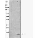 DF6116 at 1/100 staining Mouse kidney tissue by IHC-P. The sample was formaldehyde fixed and a heat mediated antigen retrieval step in citrate buffer was performed. The sample was then blocked and incubated with the antibody for 1.5 hours at 22¡ãC. An HRP conjugated goat anti-rabbit antibody was used as the secondary