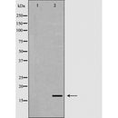 Western blot analysis of 293T lysate using FGF1 antibody. The lane on the left is treated with the antigen-specific peptide.