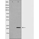DF6132 staining HepG2 by IF/ICC. The sample were fixed with PFA and permeabilized in 0.1% Triton X-100,then blocked in 10% serum for 45 minutes at 25¡ãC. The primary antibody was diluted at 1/200 and incubated with the sample for 1 hour at 37¡ãC. An Alexa Fluor 594 conjugated goat anti-rabbit IgG (H+L) Ab, diluted at 1/600, was used as the secondary antibod