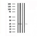 DF6133 at 1/100 staining Mouse muscle tissue by IHC-P. The sample was formaldehyde fixed and a heat mediated antigen retrieval step in citrate buffer was performed. The sample was then blocked and incubated with the antibody for 1.5 hours at 22¡ãC. An HRP conjugated goat anti-rabbit antibody was used as the secondary