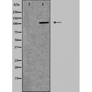 DF6135 at 1/100 staining Human pancreas tissue by IHC-P. The sample was formaldehyde fixed and a heat mediated antigen retrieval step in citrate buffer was performed. The sample was then blocked and incubated with the antibody for 1.5 hours at 22¡ãC. An HRP conjugated goat anti-rabbit antibody was used as the secondary