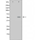 DF6138 at 1/100 staining Rat kidney tissue by IHC-P. The sample was formaldehyde fixed and a heat mediated antigen retrieval step in citrate buffer was performed. The sample was then blocked and incubated with the antibody for 1.5 hours at 22¡ãC. An HRP conjugated goat anti-rabbit antibody was used as the secondary