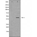 DF6139 at 1/100 staining Human urothelial cancer tissue by IHC-P. The sample was formaldehyde fixed and a heat mediated antigen retrieval step in citrate buffer was performed. The sample was then blocked and incubated with the antibody for 1.5 hours at 22¡ãC. An HRP conjugated goat anti-rabbit antibody was used as the secondary