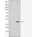 DF6140 at 1/100 staining Mouse liver tissue by IHC-P. The sample was formaldehyde fixed and a heat mediated antigen retrieval step in citrate buffer was performed. The sample was then blocked and incubated with the antibody for 1.5 hours at 22¡ãC. An HRP conjugated goat anti-rabbit antibody was used as the secondary