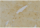 Western blot analysis of extracts from Mouse kidney, using NeuN Antibody. The lane on the left was treated with blocking peptide.