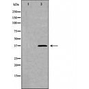 DF6149 at 1/100 staining Human lymph node tissue by IHC-P. The sample was formaldehyde fixed and a heat mediated antigen retrieval step in citrate buffer was performed. The sample was then blocked and incubated with the antibody for 1.5 hours at 22¡ãC. An HRP conjugated goat anti-rabbit antibody was used as the secondary