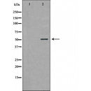 DF6150 at 1/100 staining Rat liver tissue by IHC-P. The sample was formaldehyde fixed and a heat mediated antigen retrieval step in citrate buffer was performed. The sample was then blocked and incubated with the antibody for 1.5 hours at 22¡ãC. An HRP conjugated goat anti-rabbit antibody was used as the secondary