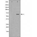 DF6153 at 1/100 staining mouse brain tissue by IHC-P. The sample was formaldehyde fixed and a heat mediated antigen retrieval step in citrate buffer was performed. The sample was then blocked and incubated with the antibody for 1.5 hours at 22¡ãC. An HRP conjugated goat anti-rabbit antibody was used as the secondary