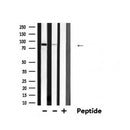 DF6154 staining LOVO by IF/ICC. The sample were fixed with PFA and permeabilized in 0.1% Triton X-100,then blocked in 10% serum for 45 minutes at 25¡ãC. The primary antibody was diluted at 1/200 and incubated with the sample for 1 hour at 37¡ãC. An Alexa Fluor 594 conjugated goat anti-rabbit IgG (H+L) Ab, diluted at 1/600, was used as the secondary antibod