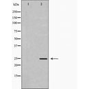 DF6158 at 1/100 staining Rat lung tissue by IHC-P. The sample was formaldehyde fixed and a heat mediated antigen retrieval step in citrate buffer was performed. The sample was then blocked and incubated with the antibody for 1.5 hours at 22¡ãC. An HRP conjugated goat anti-rabbit antibody was used as the secondary