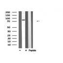 DF6171 at 1/100 staining Mouse lung tissue by IHC-P. The sample was formaldehyde fixed and a heat mediated antigen retrieval step in citrate buffer was performed. The sample was then blocked and incubated with the antibody for 1.5 hours at 22¡ãC. An HRP conjugated goat anti-rabbit antibody was used as the secondary