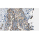 Western blot analysis of extracts from 293t, using TPMT Antibody. The lane on the left was treated with blocking peptide.
Observed bands: 35 kDa.