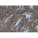 Western blot analysis of extracts from 293t, using ADA Antibody. The lane on the left was treated with blocking peptide.