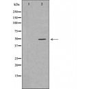 DF6185 at 1/100 staining Mouse liver tissue by IHC-P. The sample was formaldehyde fixed and a heat mediated antigen retrieval step in citrate buffer was performed. The sample was then blocked and incubated with the antibody for 1.5 hours at 22¡ãC. An HRP conjugated goat anti-rabbit antibody was used as the secondary