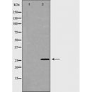 DF6193 at 1/100 staining Mouse brain tissue by IHC-P. The sample was formaldehyde fixed and a heat mediated antigen retrieval step in citrate buffer was performed. The sample was then blocked and incubated with the antibody for 1.5 hours at 22¡ãC. An HRP conjugated goat anti-rabbit antibody was used as the secondary