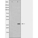DF6195 at 1/100 staining Mouse brain tissue by IHC-P. The sample was formaldehyde fixed and a heat mediated antigen retrieval step in citrate buffer was performed. The sample was then blocked and incubated with the antibody for 1.5 hours at 22¡ãC. An HRP conjugated goat anti-rabbit antibody was used as the secondary