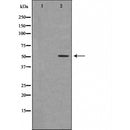 DF6198 at 1/100 staining Rat heart tissue by IHC-P. The sample was formaldehyde fixed and a heat mediated antigen retrieval step in citrate buffer was performed. The sample was then blocked and incubated with the antibody for 1.5 hours at 22¡ãC. An HRP conjugated goat anti-rabbit antibody was used as the secondary