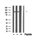 DF6199 at 1/100 staining Mouse testis tissue by IHC-P. The sample was formaldehyde fixed and a heat mediated antigen retrieval step in citrate buffer was performed. The sample was then blocked and incubated with the antibody for 1.5 hours at 22¡ãC. An HRP conjugated goat anti-rabbit antibody was used as the secondary