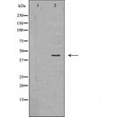 DF6250 at 1/100 staining Human uterus tissue by IHC-P. The sample was formaldehyde fixed and a heat mediated antigen retrieval step in citrate buffer was performed. The sample was then blocked and incubated with the antibody for 1.5 hours at 22¡ãC. An HRP conjugated goat anti-rabbit antibody was used as the secondary